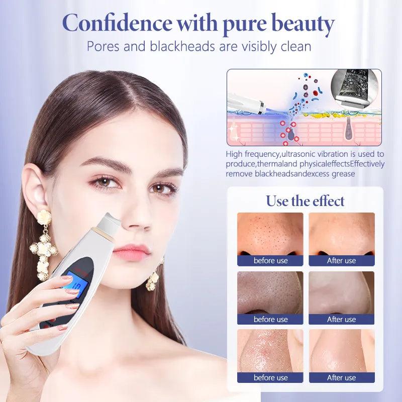 Ultrasonic Skin Scrubber Deep Face Cleaning Machine RemoveFacial Massager Ultrasound Peeling Clean Tone Lift LW006 - YOURISHOP.COM